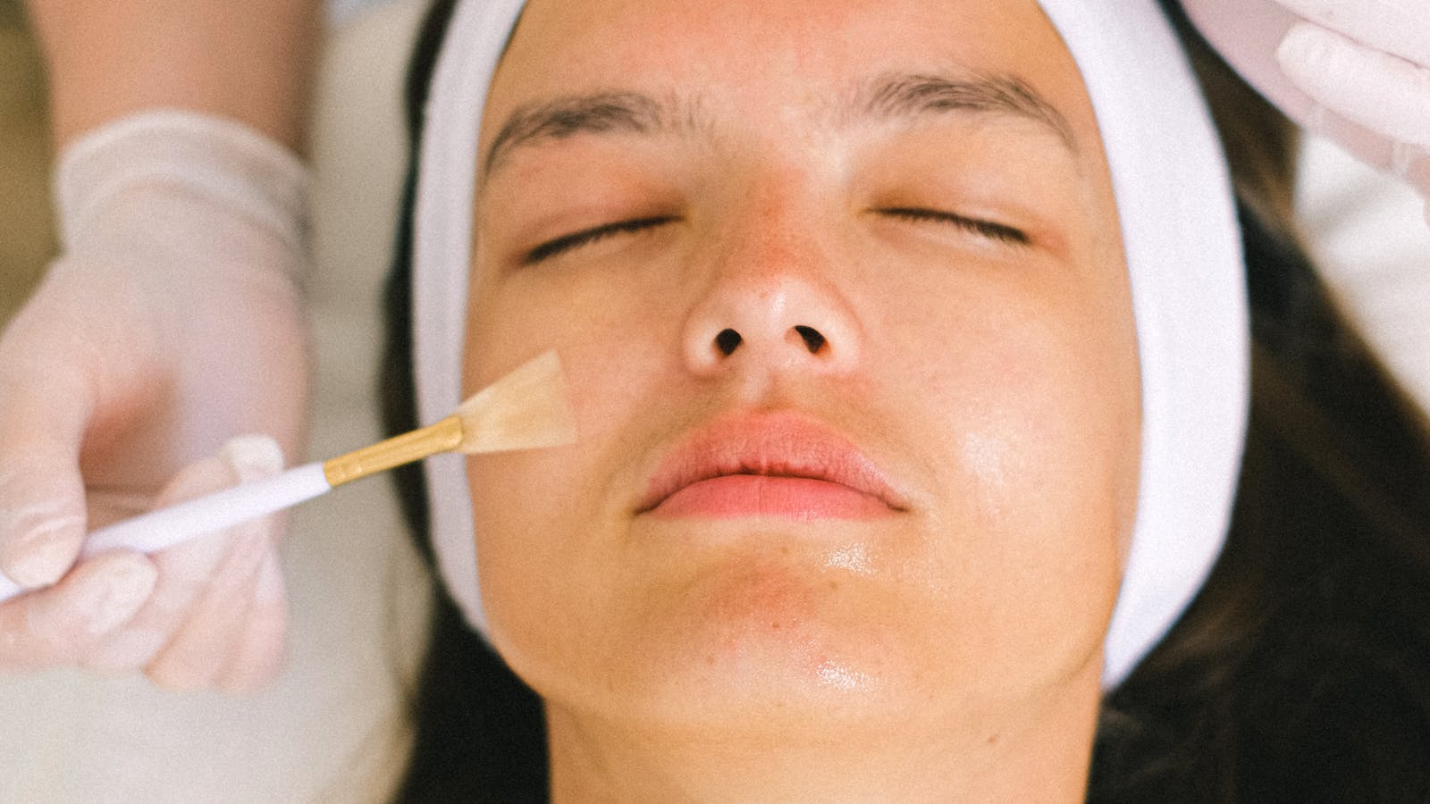 Tratamiento facial con ácido salicílico para pieles grasas